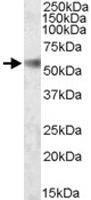 PAB11462 - SH2D4A