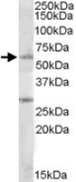 PAB11463 - SOCS7 / NAP4
