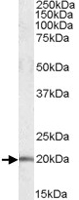 PAB11465 - U2AF1L4 / U2AF1L3
