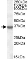 PAB11466 - Annexin A1 / ANXA1
