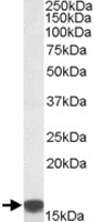 PAB11470 - S100A9 / Calgranulin-B / MRP14