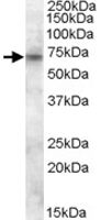 PAB11481 - ABCD3 / PMP70