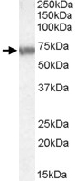 PAB11482 - ABCD4 / PXMP1L
