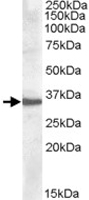 PAB11492 - Apolipoprotein F / Apo F