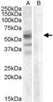 PAB11496 - Arylsulfatase D
