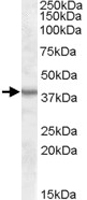 PAB11499 - ASNA1 / ARSA