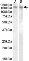 PAB11503 - Vasopressin V1b receptor (V1bR)