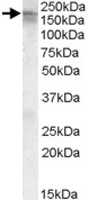 PAB11506 - CACNA1C