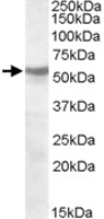 PAB11510 - Acetylcholine receptor beta subunit