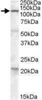 PAB11515 - DAGLA