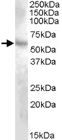PAB11518 - DMP1