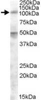 PAB11523 - ERAP2 / LRAP