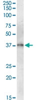 PAB11532 - GTP cyclohydrolase 1 (GCH1)