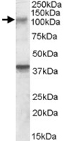 PAB11539 - GRIK3 / GLUR7