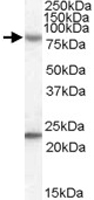PAB11548 - DHX58