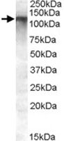 PAB11553 - ABCC11 / MRP8