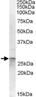 PAB11567 - Otubain-2 (OTUB2)
