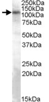 PAB11598 - TRPC4 / TRP4