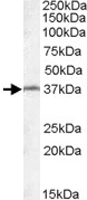 PAB11601 - RSPH1 / TSGA2