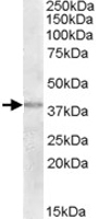PAB11602 - TXNDC6 / TXL2