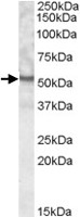 PAB11603 - UNC5CL