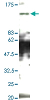 PAB1161 - MED15