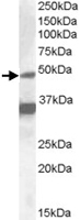 PAB11612 - NR1I2
