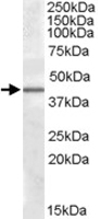 PAB11616 - CAMK1D