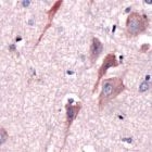 PAB11628 - Corticoliberin