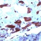 PAB11630 - Cyclooxygenase 2