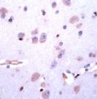 PAB11636 - Dopamine D5 receptor