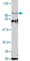 PAB1164 - MED17
