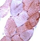 PAB11642 - Dysferlin