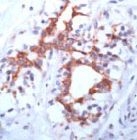 PAB11649 - CD333 / FGFR3