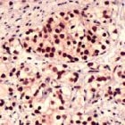 PAB11654 - FOXO1A