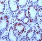 PAB11662 - Gastrin