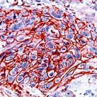 PAB11668 - GLUT1 / SLC2A1