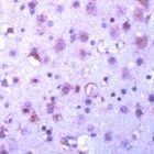PAB11674 - GSK3 alpha
