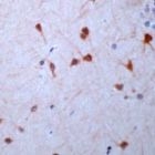 PAB11675 - Guanylate cyclase soluble GUCY1B3