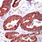 PAB11678 - HSP60