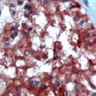 PAB11683 - Inhibin alpha / INHA