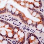 PAB11684 - Integrin beta-5 / ITGB5