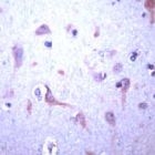 PAB11686 - JM4 / PRAF2