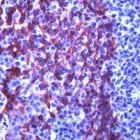 PAB11688 - Cytokeratin 5