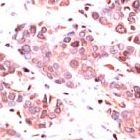 PAB11690 - Lamin-B1 (LMNB1)