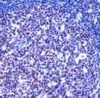 PAB11691 - Rhombotin-2