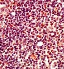 PAB11693 - MCL1