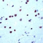 PAB11696 - MEF2A