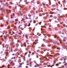 PAB11697 - mGluR1a / GRM1a