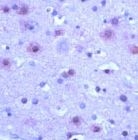 PAB11698 - mGluR5 / GRM5